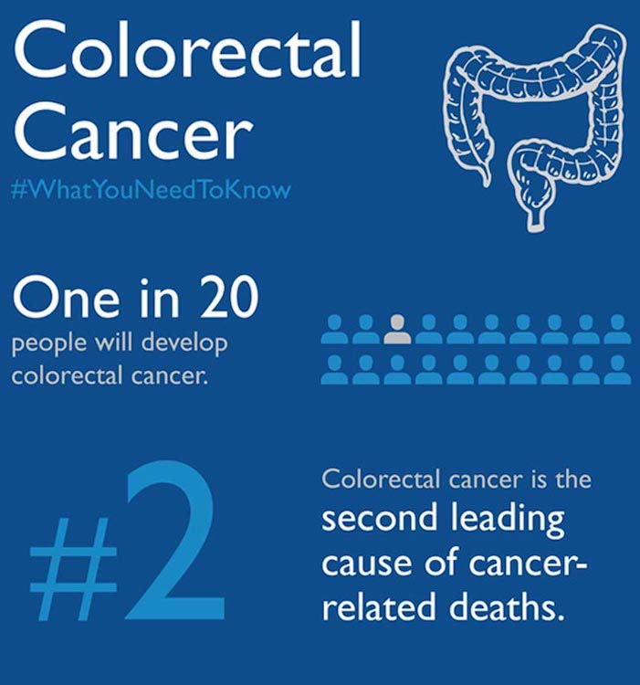 Colon Cancer is Third Most Common Cancer in Qatar: HMC - Marhaba l
